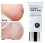 ⁦كريم معالجة علامات التمدد من العلامة التجارية Vibrant Glamour⁩ - الصورة ⁦4⁩