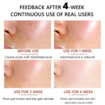 ⁦سيروم تقليص المسام 30 مل من Vibrant Glamour⁩ - الصورة ⁦6⁩