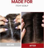 ⁦منشط فروة الرأس⁩ - الصورة ⁦7⁩